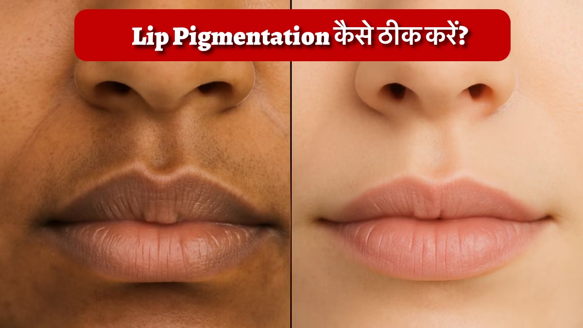 Lip Pigmentation