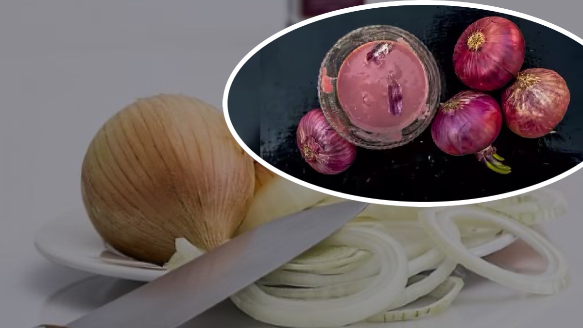 Onion Juice For Hair Fall